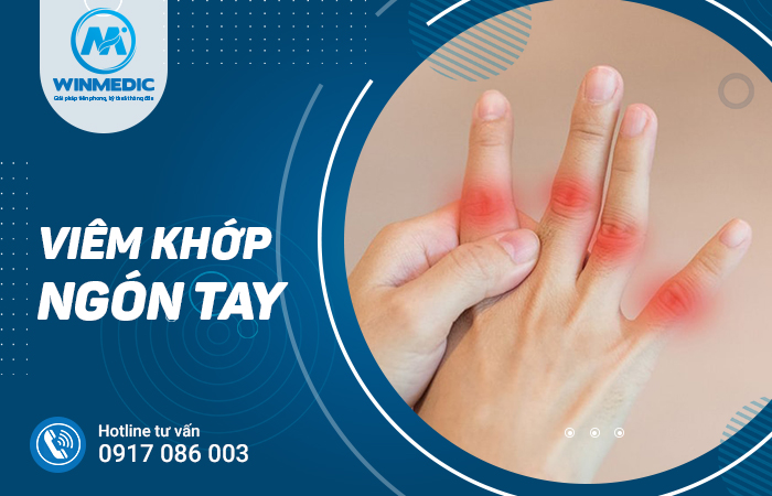 Viêm khớp ngón tay là bệnh gì? Nguyên nhân và cách điều trị