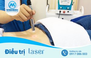 Điều trị Laser