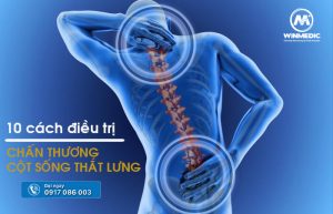 10 cach dieu tri chan thuong cot song that lung 300x193 - Tổng hợp tất cả những cách điều trị chấn thương cột sống thắt lưng hiện nay