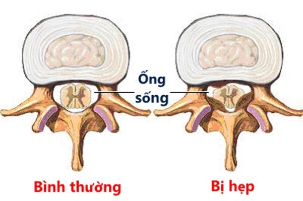 nguyen nhan khien ban dau lung lan xuong mong va chan 5 nguyen nhan khien ban dau lung lan xuong mong va chan 5
